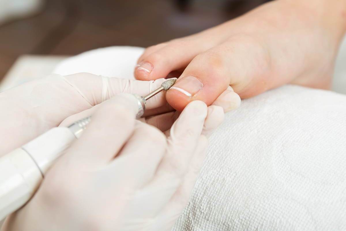 Аппаратный педикюр